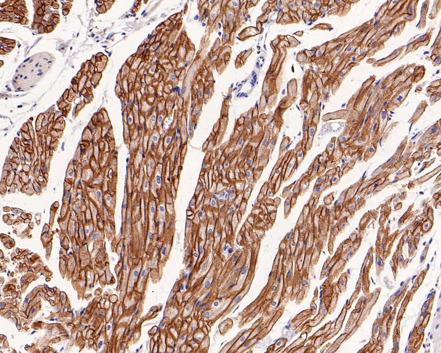 Immunohistochemical analysis of paraffin-embedded rat heart tissue with Rabbit anti-Caveolin-3 antibody (ET1607-16) at 1/1,000 dilution.<br />
<br />
The section was pre-treated using heat mediated antigen retrieval with Tris-EDTA buffer (pH 9.0) for 20 minutes. The tissues were blocked in 1% BSA for 20 minutes at room temperature, washed with ddH2O and PBS, and then probed with the primary antibody (ET1607-16) at 1/1,000 dilution for 1 hour at room temperature. The detection was performed using an HRP conjugated compact polymer system. DAB was used as the chromogen. Tissues were counterstained with hematoxylin and mounted with DPX.