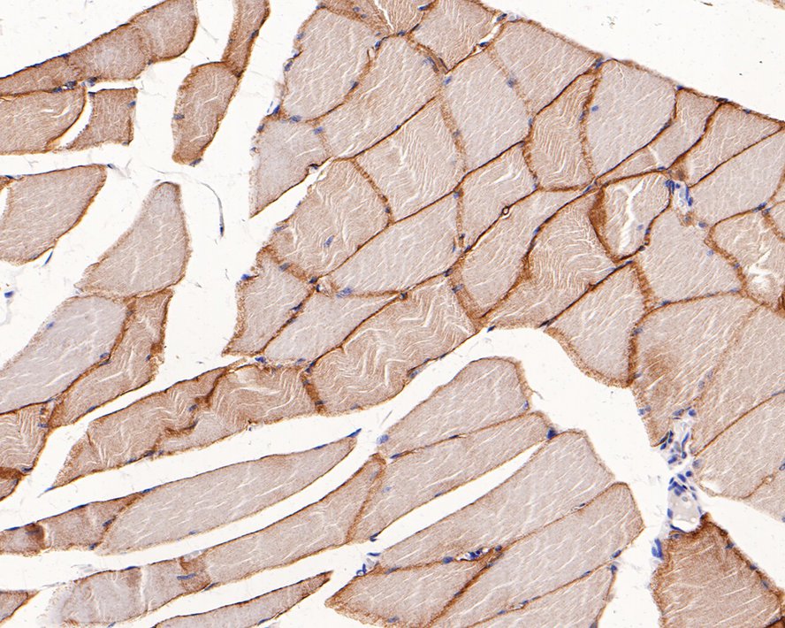 Immunohistochemical analysis of paraffin-embedded human striated muscle tissue with Rabbit anti-Caveolin-3 antibody (ET1607-16) at 1/1,000 dilution.<br />
<br />
The section was pre-treated using heat mediated antigen retrieval with Tris-EDTA buffer (pH 9.0) for 20 minutes. The tissues were blocked in 1% BSA for 20 minutes at room temperature, washed with ddH2O and PBS, and then probed with the primary antibody (ET1607-16) at 1/1,000 dilution for 1 hour at room temperature. The detection was performed using an HRP conjugated compact polymer system. DAB was used as the chromogen. Tissues were counterstained with hematoxylin and mounted with DPX.