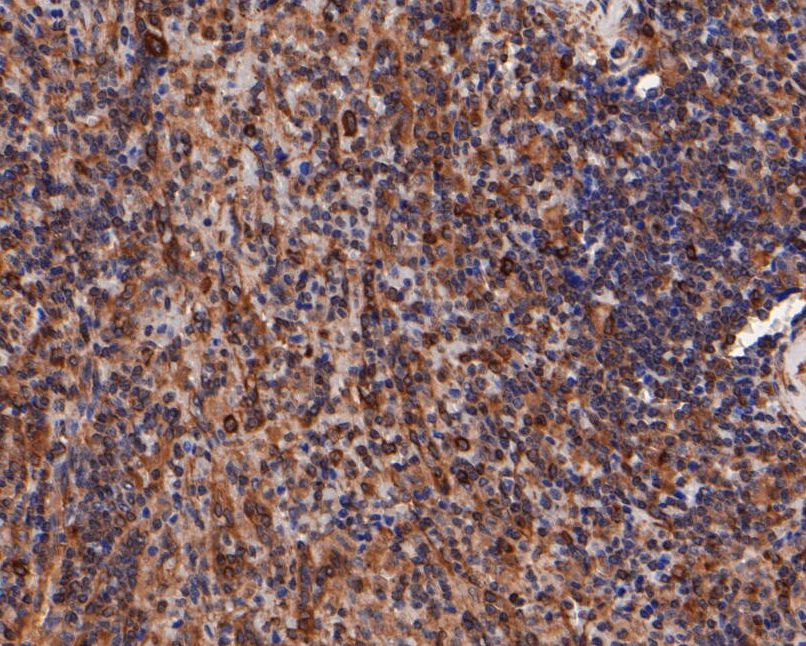 Immunohistochemical analysis of paraffin-embedded human colon tissue using anti-beta tubulin antibody. Counter stained with hematoxylin.
