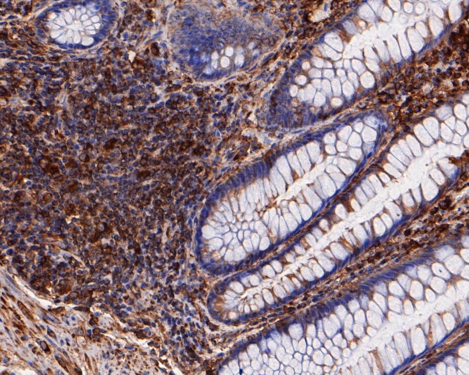 Immunohistochemical analysis of paraffin-embedded rat brain tissue using anti-beta tubulin antibody. Counter stained with hematoxylin.
