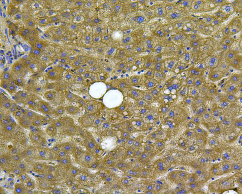 Immunohistochemical analysis of paraffin-embedded human liver tissue with Rabbit anti-Albumin antibody (0806-9) at 1/50 dilution.<br />
<br />
The section was pre-treated using heat mediated antigen retrieval with Tris-EDTA buffer (pH 9.0) for 20 minutes. The tissues were blocked in 1% BSA for 20 minutes at room temperature, washed with ddH2O and PBS, and then probed with the primary antibody (0806-9) at 1/50 dilution for 1 hour at room temperature. The detection was performed using an HRP conjugated compact polymer system. DAB was used as the chromogen. Tissues were counterstained with hematoxylin and mounted with DPX.