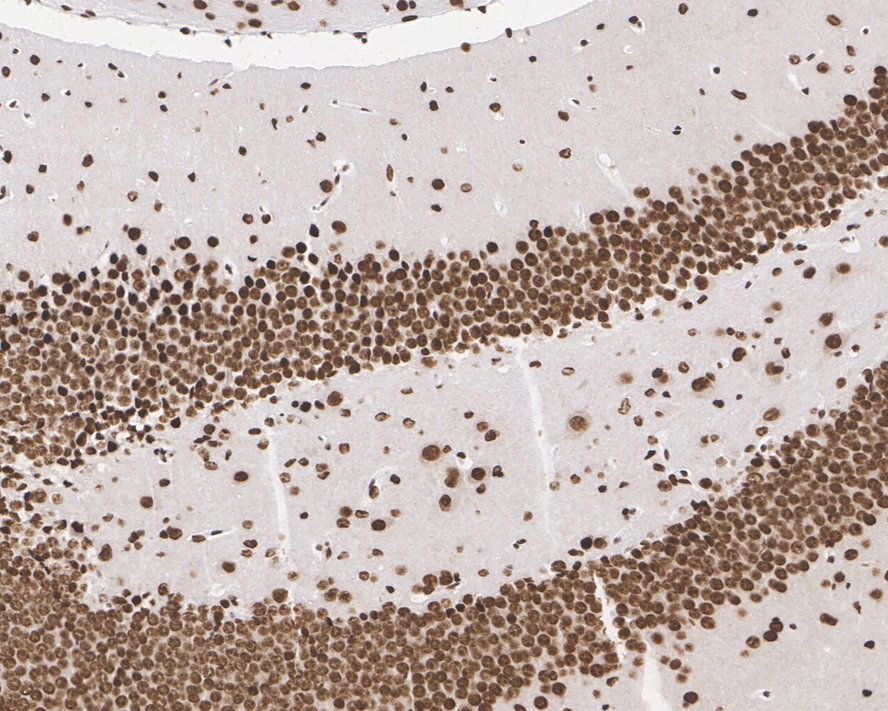 Immunohistochemical analysis of paraffin-embedded mouse brain tissue with Mouse anti-CELF-1 antibody (EM1701-77) at 1/400 dilution.<br />
<br />
The section was pre-treated using heat mediated antigen retrieval with sodium citrate buffer (pH 6.0) for 2 minutes. The tissues were blocked in 1% BSA for 20 minutes at room temperature, washed with ddH2O and PBS, and then probed with the primary antibody (EM1701-77) at 1/400 dilution for 1 hour at room temperature. The detection was performed using an HRP conjugated compact polymer system. DAB was used as the chromogen. Tissues were counterstained with hematoxylin and mounted with DPX.