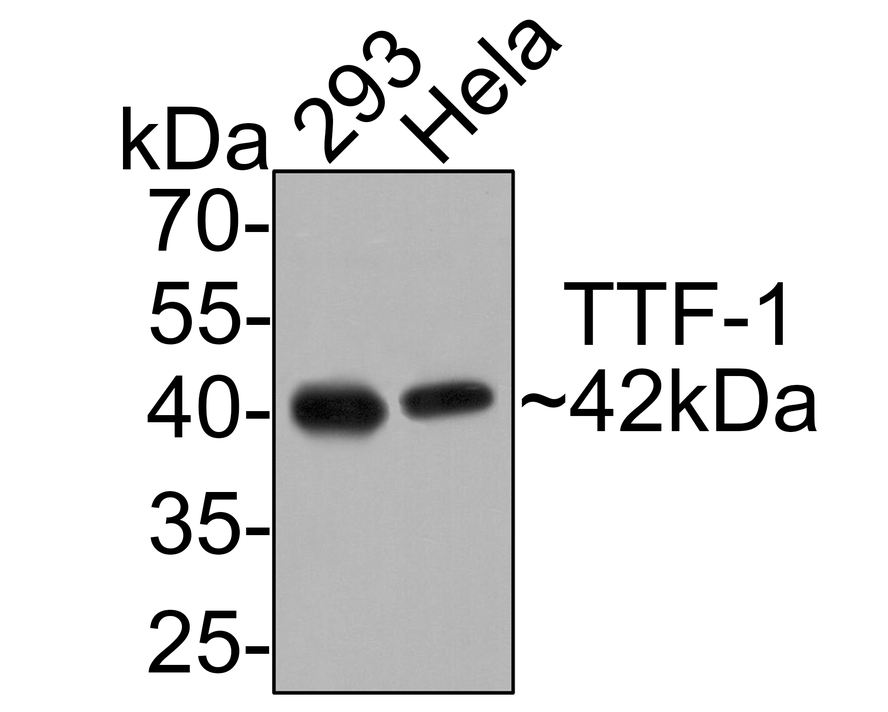 Western blot analysis of TTF-1 on different lysates with Rabbit anti-TTF-1 antibody (ER1902-68) at 1/500 dilution.<br />
<br />
Lane 1: 293 cell lysate<br />
Lane 2: Hela cell lysate<br />
<br />
Lysates/proteins at 10 µg/Lane.<br />
<br />
Predicted band size: 42/39 kDa<br />
Observed band size: 42 kDa<br />
<br />
Exposure time: 2 minutes;<br />
<br />
12% SDS-PAGE gel.<br />
<br />
Proteins were transferred to a PVDF membrane and blocked with 5% NFDM/TBST for 1 hour at room temperature. The primary antibody (ER1902-68) at 1/500 dilution was used in 5% NFDM/TBST at room temperature for 2 hours. Goat Anti-Rabbit IgG - HRP Secondary Antibody (HA1001) at 1:300,000 dilution was used for 1 hour at room temperature.