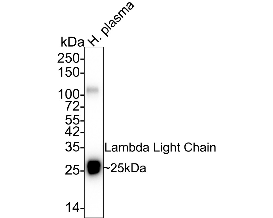 Lambda Light Chain Mouse Monoclonal Antibody – HUABIO