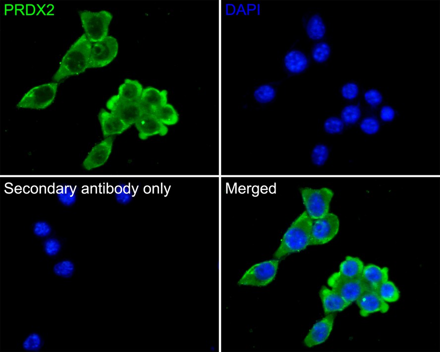 Immunocytochemistry analysis of PC-3 cells labeling PRDX2 with Mouse anti-PRDX2 antibody (EM1701-70) at 1/50 dilution.<br />
<br />
Cells were fixed in 4% paraformaldehyde for 30 minutes, permeabilized with 0.1% Triton X-100 in PBS for 15 minutes, and then blocked with 2% BSA for 30 minutes at room temperature. Cells were then incubated with Mouse anti-PRDX2 antibody (EM1701-70) at 1/100 dilution in 2% BSA overnight at 4 ℃. Goat Anti-Mouse IgG H&L (iFluor™ 488, HA1125) was used as the secondary antibody at 1/1,000 dilution. PBS instead of the primary antibody was used as the secondary antibody only control. Nuclear DNA was labelled in blue with DAPI.