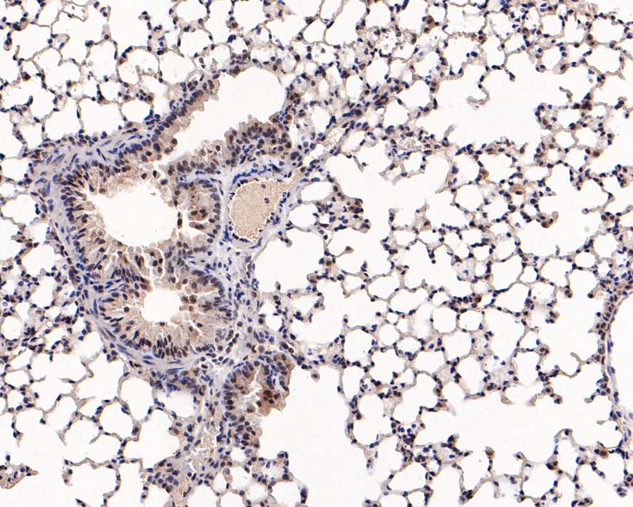 Immunohistochemical analysis of paraffin-embedded mouse lung tissue with Rabbit anti-Phospho-AKT1 (T450) antibody (ET1612-73) at 1/200 dilution.<br />
<br />
The section was pre-treated using heat mediated antigen retrieval with Tris-EDTA buffer (pH 9.0) for 20 minutes. The tissues were blocked in 1% BSA for 20 minutes at room temperature, washed with ddH2O and PBS, and then probed with the primary antibody (ET1612-73) at 1/200 dilution for 1 hour at room temperature. The detection was performed using an HRP conjugated compact polymer system. DAB was used as the chromogen. Tissues were counterstained with hematoxylin and mounted with DPX.