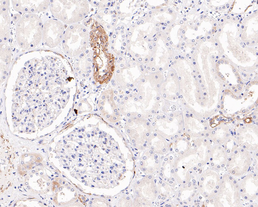Immunohistochemical analysis of paraffin-embedded human kidney tissue with Rabbit anti-Caveolin-1 antibody (0407-6) at 1/100 dilution.<br />
<br />
The section was pre-treated using heat mediated antigen retrieval with Tris-EDTA buffer (pH 9.0) for 20 minutes. The tissues were blocked in 1% BSA for 20 minutes at room temperature, washed with ddH2O and PBS, and then probed with the primary antibody (0407-6) at 1/100 dilution for 1 hour at room temperature. The detection was performed using an HRP conjugated compact polymer system. DAB was used as the chromogen. Tissues were counterstained with hematoxylin and mounted with DPX.