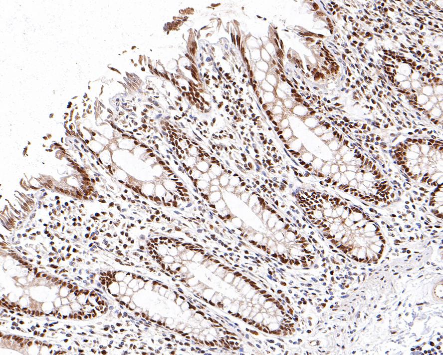 Immunohistochemical analysis of paraffin-embedded human colon tissue with Rabbit anti-DPPA2 antibody (0731-4) at 1/1,000 dilution.<br />
<br />
The section was pre-treated using heat mediated antigen retrieval with sodium citrate buffer (pH 6.0) for 2 minutes. The tissues were blocked in 1% BSA for 20 minutes at room temperature, washed with ddH2O and PBS, and then probed with the primary antibody (0731-4) at 1/1,000 dilution for 1 hour at room temperature. The detection was performed using an HRP conjugated compact polymer system. DAB was used as the chromogen. Tissues were counterstained with hematoxylin and mounted with DPX.