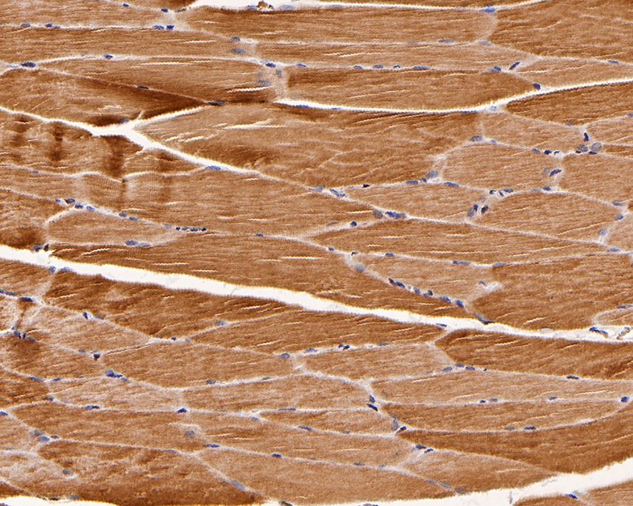 Immunohistochemical analysis of paraffin-embedded rat skeletal muscle tissue with Rabbit anti-Junctophilin-2 antibody (0407-9) at 1/400 dilution.<br />
<br />
The section was pre-treated using heat mediated antigen retrieval with Tris-EDTA buffer (pH 9.0) for 20 minutes. The tissues were blocked in 1% BSA for 20 minutes at room temperature, washed with ddH2O and PBS, and then probed with the primary antibody (0407-9) at 1/400 dilution for 1 hour at room temperature. The detection was performed using an HRP conjugated compact polymer system. DAB was used as the chromogen. Tissues were counterstained with hematoxylin and mounted with DPX.