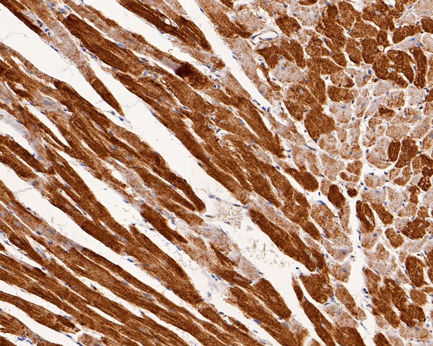 Immunohistochemical analysis of paraffin-embedded rat heart tissue with Rabbit anti-Junctophilin-2 antibody (0407-9) at 1/400 dilution.<br />
<br />
The section was pre-treated using heat mediated antigen retrieval with Tris-EDTA buffer (pH 9.0) for 20 minutes. The tissues were blocked in 1% BSA for 20 minutes at room temperature, washed with ddH2O and PBS, and then probed with the primary antibody (0407-9) at 1/400 dilution for 1 hour at room temperature. The detection was performed using an HRP conjugated compact polymer system. DAB was used as the chromogen. Tissues were counterstained with hematoxylin and mounted with DPX.
