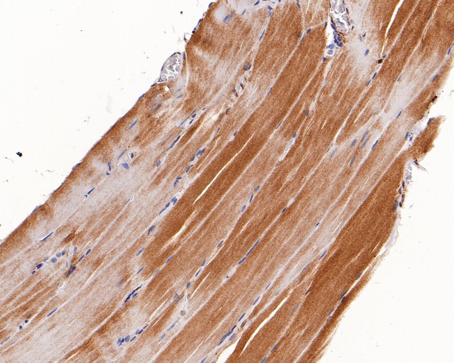 Immunohistochemical analysis of paraffin-embedded human striated muscle tissue with Rabbit anti-Junctophilin-2 antibody (0407-9) at 1/400 dilution.<br />
<br />
The section was pre-treated using heat mediated antigen retrieval with Tris-EDTA buffer (pH 9.0) for 20 minutes. The tissues were blocked in 1% BSA for 20 minutes at room temperature, washed with ddH2O and PBS, and then probed with the primary antibody (0407-9) at 1/400 dilution for 1 hour at room temperature. The detection was performed using an HRP conjugated compact polymer system. DAB was used as the chromogen. Tissues were counterstained with hematoxylin and mounted with DPX.