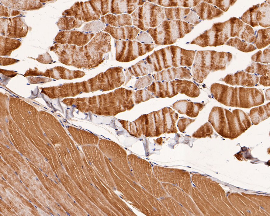 Immunohistochemical analysis of paraffin-embedded mouse skeletal muscle tissue with Rabbit anti-Junctophilin-2 antibody (0407-9) at 1/400 dilution.<br />
<br />
The section was pre-treated using heat mediated antigen retrieval with Tris-EDTA buffer (pH 9.0) for 20 minutes. The tissues were blocked in 1% BSA for 20 minutes at room temperature, washed with ddH2O and PBS, and then probed with the primary antibody (0407-9) at 1/400 dilution for 1 hour at room temperature. The detection was performed using an HRP conjugated compact polymer system. DAB was used as the chromogen. Tissues were counterstained with hematoxylin and mounted with DPX.