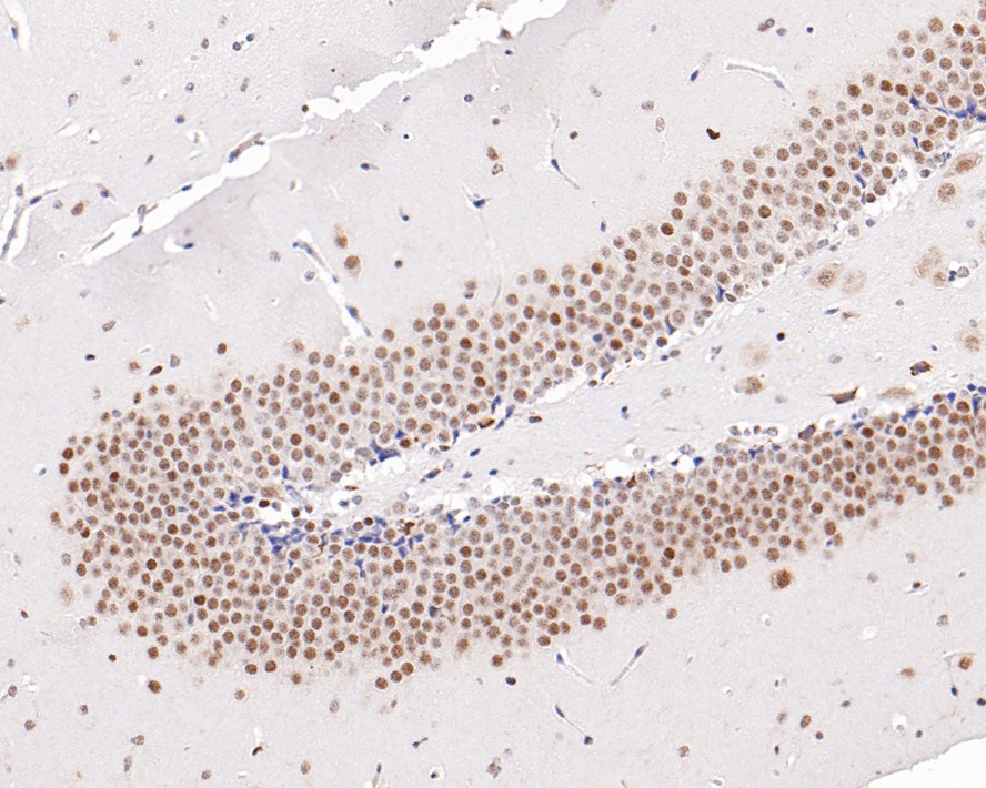 Immunohistochemical analysis of paraffin-embedded mouse hippocampus tissue with Mouse anti-PGBD5 antibody (M1012-1) at 1/400 dilution.<br />
<br />
The section was pre-treated using heat mediated antigen retrieval with sodium citrate buffer (pH 6.0) for 2 minutes. The tissues were blocked in 1% BSA for 20 minutes at room temperature, washed with ddH2O and PBS, and then probed with the primary antibody (M1012-1) at 1/400 dilution for 1 hour at room temperature. The detection was performed using an HRP conjugated compact polymer system. DAB was used as the chromogen. Tissues were counterstained with hematoxylin and mounted with DPX.