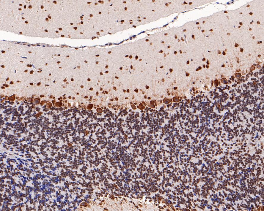 Immunohistochemical analysis of paraffin-embedded mouse cerebellum tissue with Mouse anti-PGBD5 antibody (M1012-1) at 1/100 dilution.<br />
<br />
The section was pre-treated using heat mediated antigen retrieval with sodium citrate buffer (pH 6.0) for 2 minutes. The tissues were blocked in 1% BSA for 20 minutes at room temperature, washed with ddH2O and PBS, and then probed with the primary antibody (M1012-1) at 1/100 dilution for 1 hour at room temperature. The detection was performed using an HRP conjugated compact polymer system. DAB was used as the chromogen. Tissues were counterstained with hematoxylin and mounted with DPX.