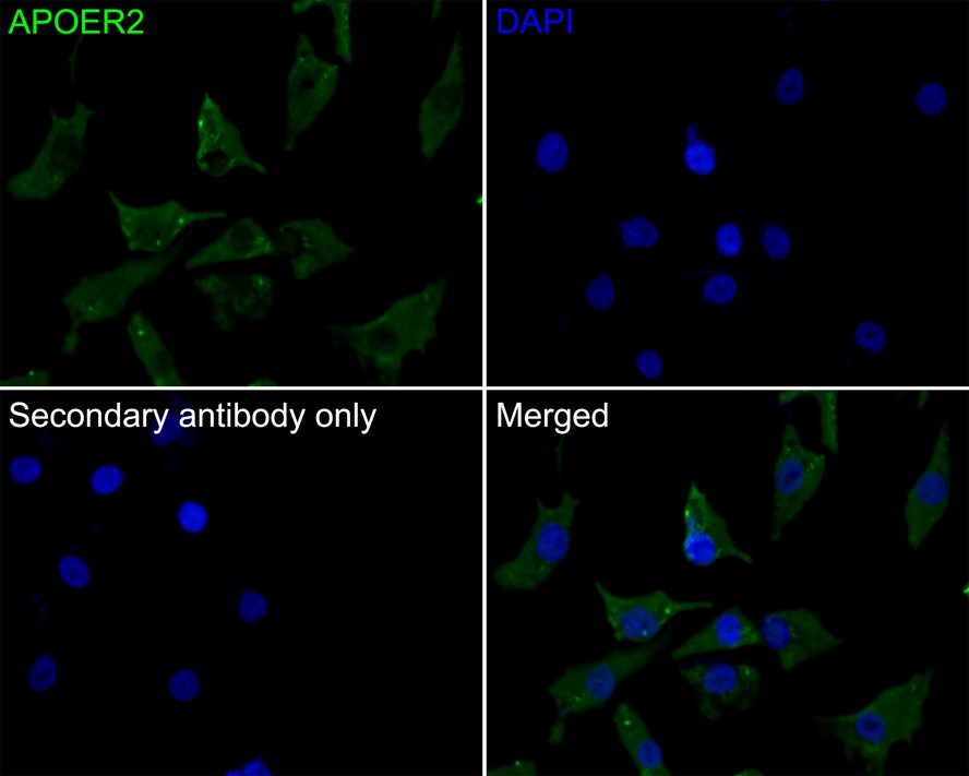 Immunocytochemistry analysis of A549 cells labeling APOER2 with Mouse anti-APOER2 antibody (EM1902-30) at 1/50 dilution.<br />
<br />
Cells were fixed in 4% paraformaldehyde for 30 minutes, permeabilized with 0.1% Triton X-100 in PBS for 15 minutes, and then blocked with 2% BSA for 30 minutes at room temperature. Cells were then incubated with Mouse anti-APOER2 antibody (EM1902-30) at 1/50 dilution in 2% BSA overnight at 4 ℃. Goat Anti-Mouse IgG H&L (iFluor™ 488, HA1125) was used as the secondary antibody at 1/1,000 dilution. PBS instead of the primary antibody was used as the secondary antibody only control. Nuclear DNA was labelled in blue with DAPI.