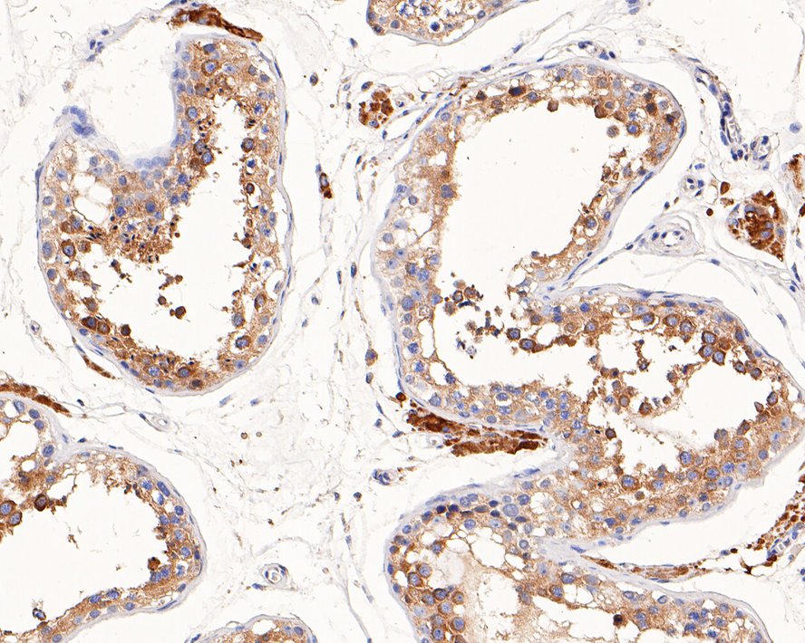 Immunohistochemical analysis of paraffin-embedded human testis tissue with Mouse anti-APOER2 antibody (EM1902-30) at 1/400 dilution.<br />
<br />
The section was pre-treated using heat mediated antigen retrieval with Tris-EDTA buffer (pH 9.0) for 20 minutes. The tissues were blocked in 1% BSA for 20 minutes at room temperature, washed with ddH2O and PBS, and then probed with the primary antibody (EM1902-30) at 1/400 dilution for 1 hour at room temperature. The detection was performed using an HRP conjugated compact polymer system. DAB was used as the chromogen. Tissues were counterstained with hematoxylin and mounted with DPX.