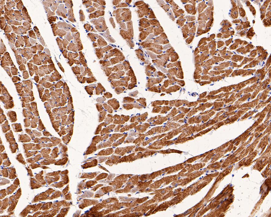Immunohistochemical analysis of paraffin-embedded rat heart tissue with Rabbit anti-alpha Actin (cardiac actin) antibody (0407-3) at 1/400 dilution.<br />
<br />
The section was pre-treated using heat mediated antigen retrieval with Tris-EDTA buffer (pH 9.0) for 20 minutes. The tissues were blocked in 1% BSA for 20 minutes at room temperature, washed with ddH2O and PBS, and then probed with the primary antibody (0407-3) at 1/400 dilution for 1 hour at room temperature. The detection was performed using an HRP conjugated compact polymer system. DAB was used as the chromogen. Tissues were counterstained with hematoxylin and mounted with DPX.
