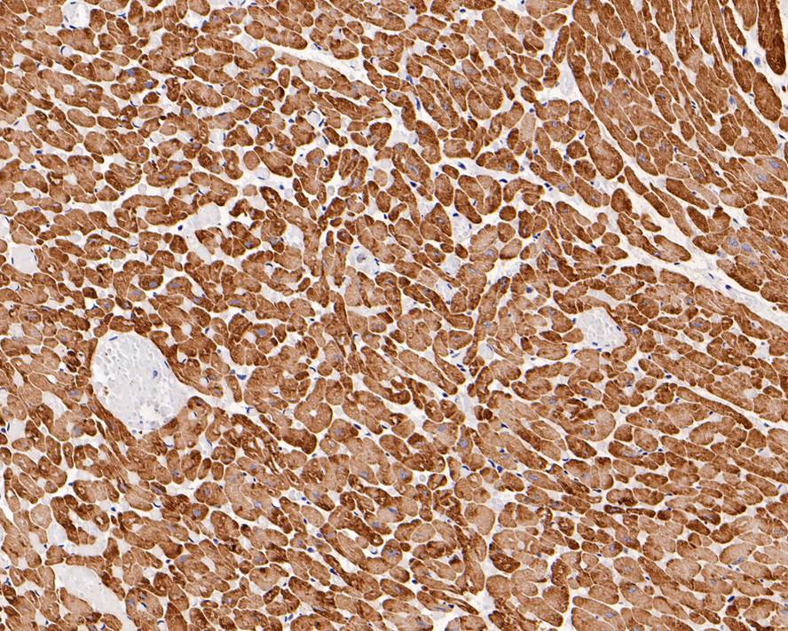 Immunohistochemical analysis of paraffin-embedded human heart tissue with Rabbit anti-alpha Actin (cardiac actin) antibody (0407-3) at 1/400 dilution.<br />
<br />
The section was pre-treated using heat mediated antigen retrieval with Tris-EDTA buffer (pH 9.0) for 20 minutes. The tissues were blocked in 1% BSA for 20 minutes at room temperature, washed with ddH2O and PBS, and then probed with the primary antibody (0407-3) at 1/400 dilution for 1 hour at room temperature. The detection was performed using an HRP conjugated compact polymer system. DAB was used as the chromogen. Tissues were counterstained with hematoxylin and mounted with DPX.
