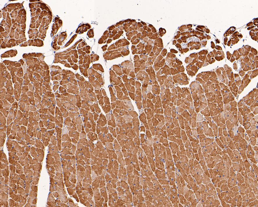 Immunohistochemical analysis of paraffin-embedded mouse heart tissue with Rabbit anti-alpha Actin (cardiac actin) antibody (0407-3) at 1/400 dilution.<br />
<br />
The section was pre-treated using heat mediated antigen retrieval with Tris-EDTA buffer (pH 9.0) for 20 minutes. The tissues were blocked in 1% BSA for 20 minutes at room temperature, washed with ddH2O and PBS, and then probed with the primary antibody (0407-3) at 1/400 dilution for 1 hour at room temperature. The detection was performed using an HRP conjugated compact polymer system. DAB was used as the chromogen. Tissues were counterstained with hematoxylin and mounted with DPX.