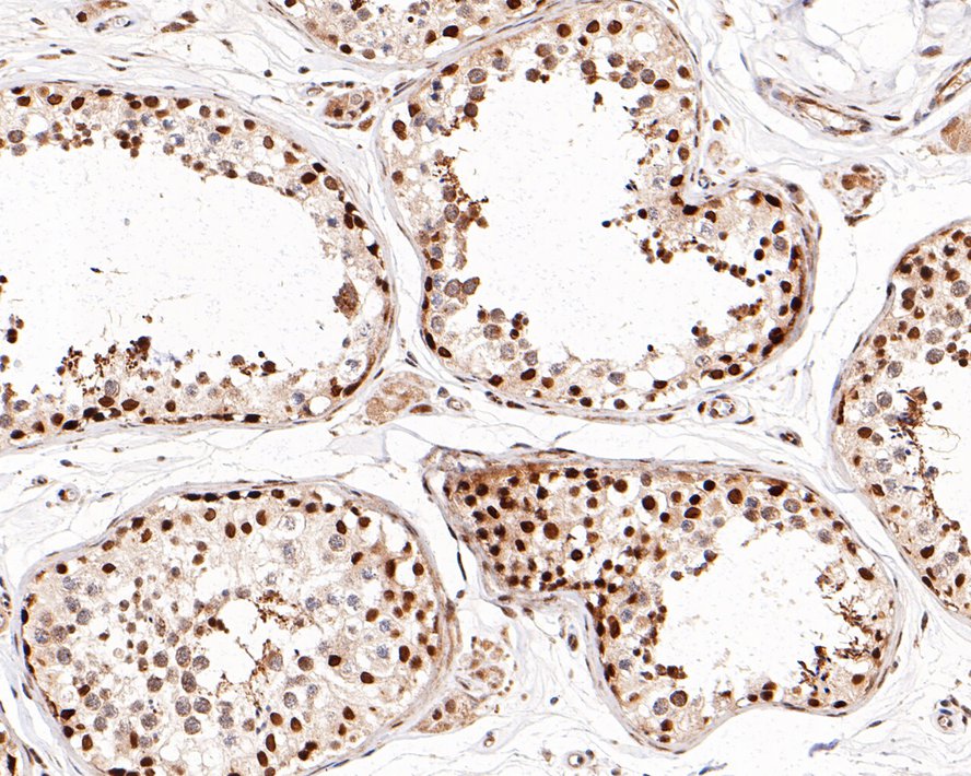 Immunohistochemical analysis of paraffin-embedded human testis tissue with Rabbit anti-DPPA2 antibody (0731-4) at 1/1,000 dilution.<br />
<br />
The section was pre-treated using heat mediated antigen retrieval with sodium citrate buffer (pH 6.0) for 2 minutes. The tissues were blocked in 1% BSA for 20 minutes at room temperature, washed with ddH2O and PBS, and then probed with the primary antibody (0731-4) at 1/1,000 dilution for 1 hour at room temperature. The detection was performed using an HRP conjugated compact polymer system. DAB was used as the chromogen. Tissues were counterstained with hematoxylin and mounted with DPX.