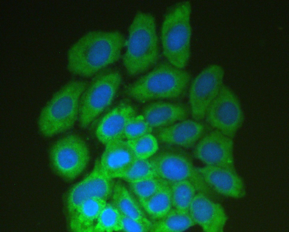 Immunocytochemistry analysis of HepG2 cells labeling ROCK1 with Rabbit anti-ROCK1 antibody (ER40122) at 1/50 dilution.<br />
<br />
Cells were fixed in 4% paraformaldehyde for 10 minutes at 37 ℃, permeabilized with 0.05% Triton X-100 in PBS for 20 minutes, and then blocked with 2% negative goat serum for 30 minutes at room temperature. Cells were then incubated with Rabbit anti-ROCK1 antibody (ER40122) at 1/50 dilution in 2% negative goat serum overnight at 4 ℃. Goat Anti-Rabbit IgG H&L(FITC) was used as the secondary antibody. Nuclear DNA was labelled in blue with DAPI.
