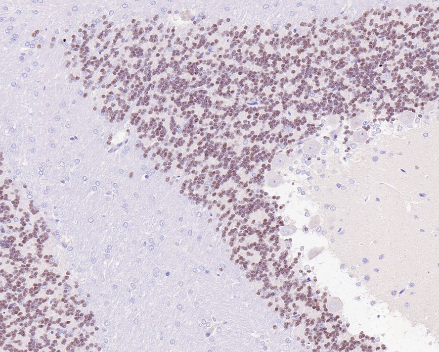 Immunohistochemical analysis of paraffin-embedded rat cerebellum tissue with Rabbit anti-NeuroD1 antibody (ET1703-73) at 1/200 dilution.<br />
<br />
The section was pre-treated using heat mediated antigen retrieval with sodium citrate buffer (pH 6.0) for 2 minutes. The tissues were blocked in 1% BSA for 20 minutes at room temperature, washed with ddH2O and PBS, and then probed with the primary antibody (ET1703-73) at 1/200 dilution for 1 hour at room temperature. The detection was performed using an HRP conjugated compact polymer system. DAB was used as the chromogen. Tissues were counterstained with hematoxylin and mounted with DPX.