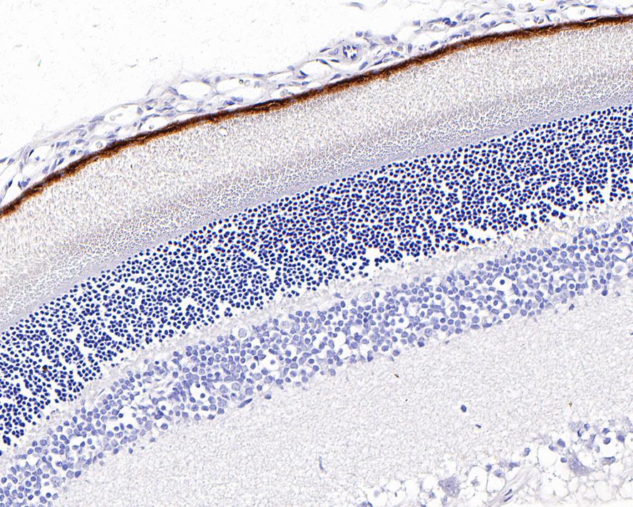 Immunohistochemical analysis of paraffin-embedded rat eyeball tissue with Rabbit anti-RPE65 antibody (ET1703-82) at 1/1,000 dilution.<br />
<br />
The section was pre-treated using heat mediated antigen retrieval with Tris-EDTA buffer (pH 9.0) for 20 minutes. The tissues were blocked in 1% BSA for 20 minutes at room temperature, washed with ddH2O and PBS, and then probed with the primary antibody (ET1703-82) at 1/1,000 dilution for 1 hour at room temperature. The detection was performed using an HRP conjugated compact polymer system. DAB was used as the chromogen. Tissues were counterstained with hematoxylin and mounted with DPX.