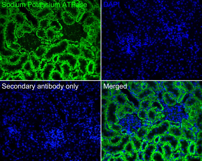Immunofluorescence analysis of paraffin-embedded rat kidney tissue labeling Sodium Potassium ATPase with Rabbit anti-Sodium Potassium ATPase antibody (ET1609-76) at 1/200 dilution.<br />
<br />
The section was pre-treated using heat mediated antigen retrieval with Tris-EDTA buffer (pH 9.0) for 20 minutes. The tissues were blocked in 10% negative goat serum for 1 hour at room temperature, washed with PBS, and then probed with the primary antibody (ET1609-76, green) at 1/200 dilution overnight at 4 ℃, washed with PBS.<br />
<br />
Goat Anti-Rabbit IgG H&L (iFluor™ 488, HA1121) was used as the secondary antibody at 1/1,000 dilution. Nuclei were counterstained with DAPI (blue).
