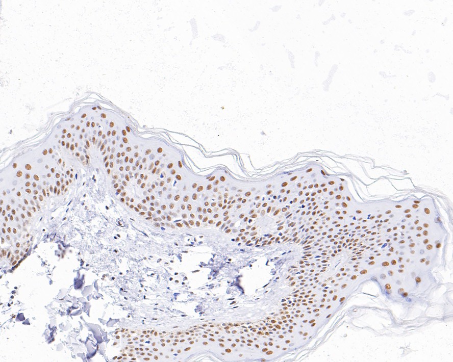 Immunohistochemical analysis of paraffin-embedded human skin tissue with Rabbit anti-HDAC3 antibody (ET1610-5) at 1/1,000 dilution.<br />
<br />
The section was pre-treated using heat mediated antigen retrieval with sodium citrate buffer (pH 6.0) for 2 minutes. The tissues were blocked in 1% BSA for 20 minutes at room temperature, washed with ddH2O and PBS, and then probed with the primary antibody (ET1610-5) at 1/1,000 dilution for 1 hour at room temperature. The detection was performed using an HRP conjugated compact polymer system. DAB was used as the chromogen. Tissues were counterstained with hematoxylin and mounted with DPX.