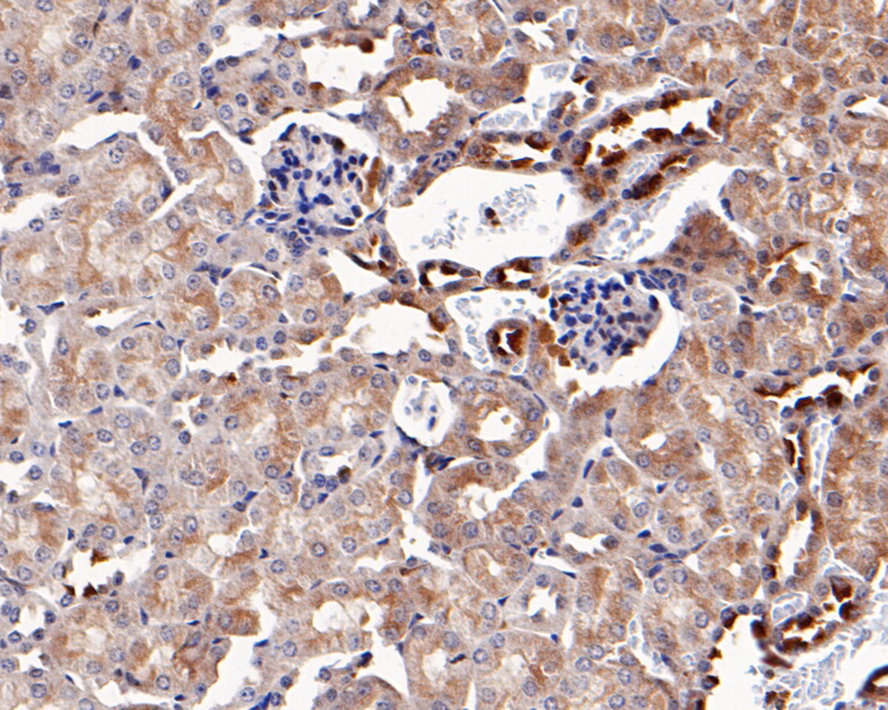 Immunohistochemical analysis of paraffin-embedded mouse kidney tissue with Rabbit anti-JAK2 antibody (ER1706-58) at 1/400 dilution.<br />
<br />
The section was pre-treated using heat mediated antigen retrieval with sodium citrate buffer (pH 6.0) for 2 minutes. The tissues were blocked in 1% BSA for 20 minutes at room temperature, washed with ddH2O and PBS, and then probed with the primary antibody (ER1706-58) at 1/400 dilution for 1 hour at room temperature. The detection was performed using an HRP conjugated compact polymer system. DAB was used as the chromogen. Tissues were counterstained with hematoxylin and mounted with DPX.