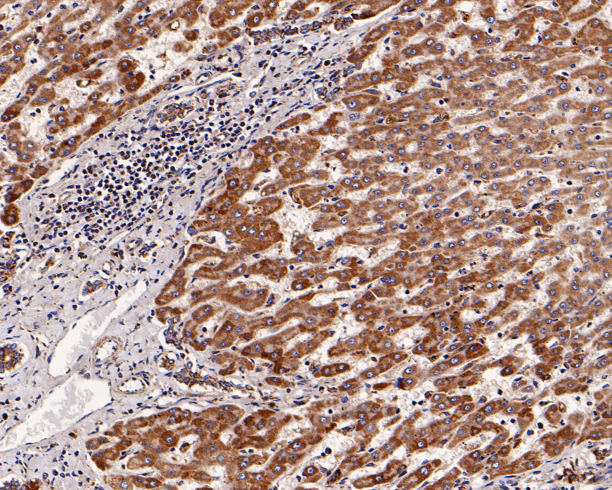 Immunohistochemical analysis of paraffin-embedded human liver tissue with Rabbit anti-Pannexin 2 antibody (ER1901-05) at 1/400 dilution.<br />
<br />
The section was pre-treated using heat mediated antigen retrieval with Tris-EDTA buffer (pH 9.0) for 20 minutes. The tissues were blocked in 1% BSA for 20 minutes at room temperature, washed with ddH2O and PBS, and then probed with the primary antibody (ER1901-05) at 1/400 dilution for 1 hour at room temperature. The detection was performed using an HRP conjugated compact polymer system. DAB was used as the chromogen. Tissues were counterstained with hematoxylin and mounted with DPX.