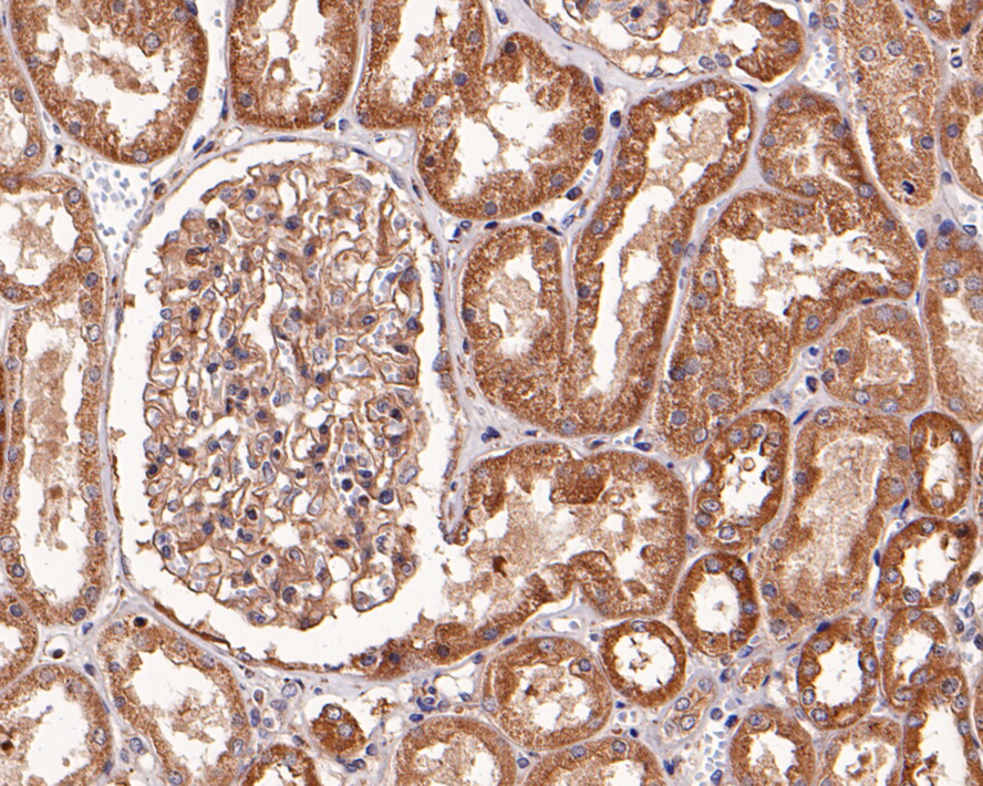 Immunohistochemical analysis of paraffin-embedded human kidney tissue with Rabbit anti-Pannexin 2 antibody (ER1901-05) at 1/400 dilution.<br />
<br />
The section was pre-treated using heat mediated antigen retrieval with Tris-EDTA buffer (pH 9.0) for 20 minutes. The tissues were blocked in 1% BSA for 20 minutes at room temperature, washed with ddH2O and PBS, and then probed with the primary antibody (ER1901-05) at 1/400 dilution for 1 hour at room temperature. The detection was performed using an HRP conjugated compact polymer system. DAB was used as the chromogen. Tissues were counterstained with hematoxylin and mounted with DPX.