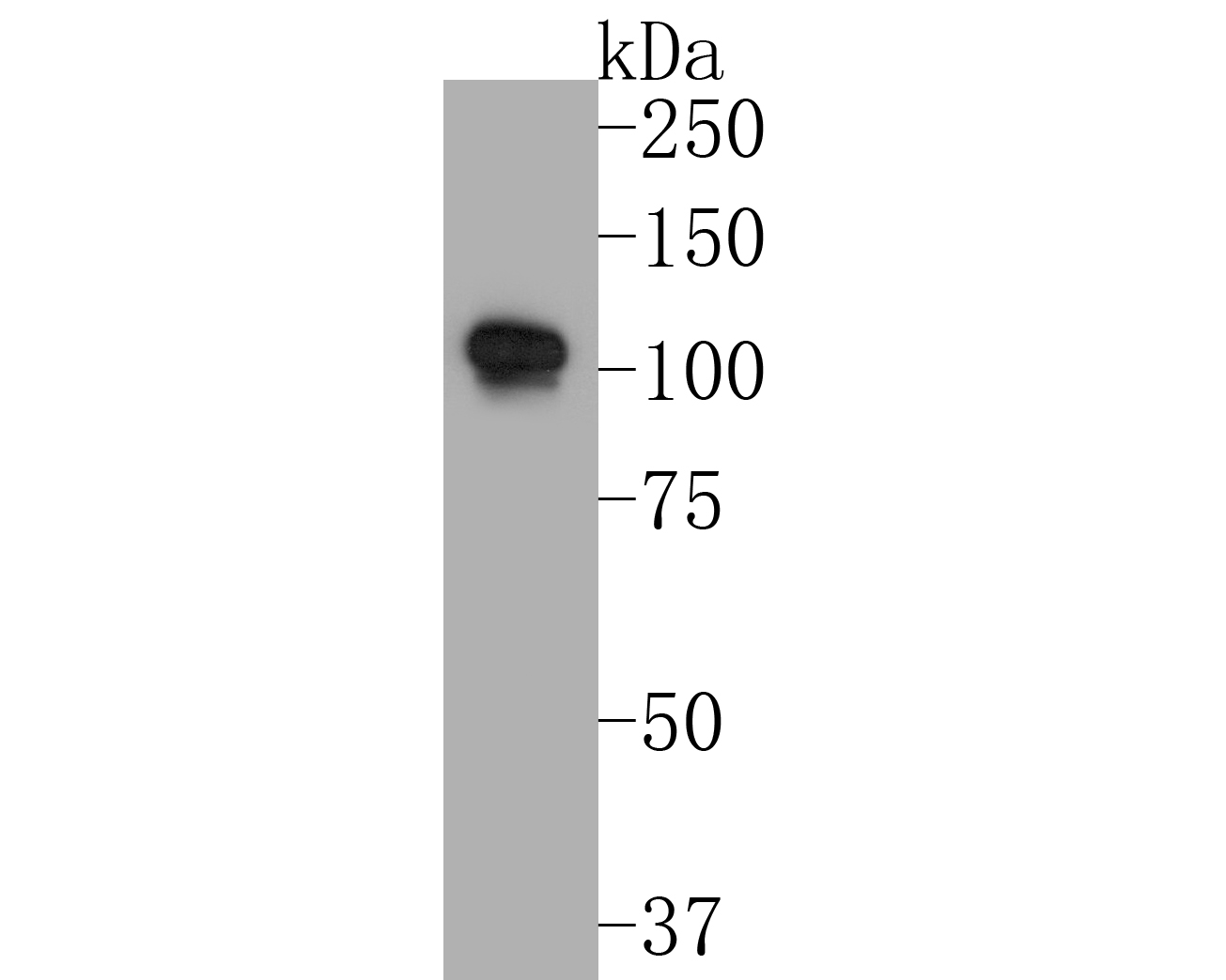 Western blot analysis of CD43 on K562 cell lysates with Rabbit anti-CD43 antibody (ER1901-28) at 1/1,000 dilution.<br />
<br />
Lysates/proteins at 10 µg/Lane.<br />
<br />
Predicted band size: 40 kDa<br />
Observed band size: 110 kDa<br />
<br />
Exposure time: 1 minute;<br />
<br />
8% SDS-PAGE gel.<br />
<br />
Proteins were transferred to a PVDF membrane and blocked with 5% NFDM/TBST for 1 hour at room temperature. The primary antibody (ER1901-28) at 1/1,000 dilution was used in 5% NFDM/TBST at room temperature for 2 hours. Goat Anti-Rabbit IgG - HRP Secondary Antibody (HA1001) at 1:300,000 dilution was used for 1 hour at room temperature.