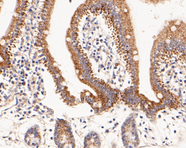 Immunohistochemical analysis of paraffin-embedded mouse small intestine tissue using anti-FH antibody. The section was pre-treated using heat mediated antigen retrieval with Tris-EDTA buffer (pH 8.0-8.4) for 20 minutes.The tissues were blocked in 5% BSA for 30 minutes at room temperature, washed with ddH2O and PBS, and then probed with the primary antibody (ER1901-10, 1/50) for 30 minutes at room temperature. The detection was performed using an HRP conjugated compact polymer system. DAB was used as the chromogen. Tissues were counterstained with hematoxylin and mounted with DPX.