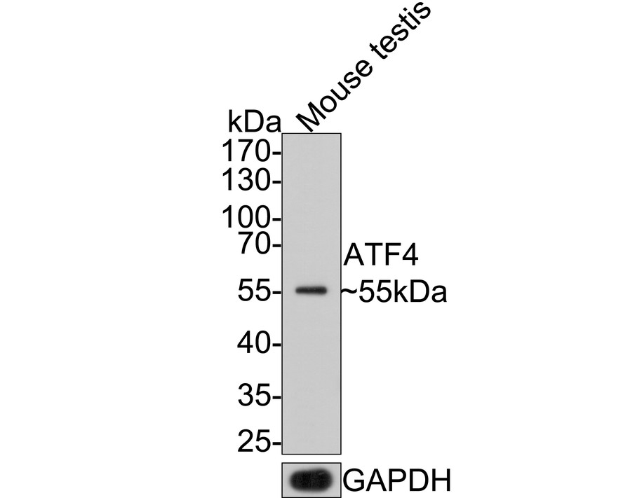 Western blot analysis of ATF4 on mouse testis tissue lysates with Rabbit anti-ATF4 antibody (ET1612-37) at 1/500 dilution.<br />
<br />
Lysates/proteins at 20 µg/Lane.<br />
<br />
Predicted band size: 39 kDa<br />
Observed band size: 55 kDa<br />
<br />
Exposure time: 2 minutes;<br />
<br />
10% SDS-PAGE gel.<br />
<br />
Proteins were transferred to a PVDF membrane and blocked with 5% NFDM/TBST for 1 hour at room temperature. The primary antibody (ET1612-37) at 1/500 dilution was used in 5% NFDM/TBST at room temperature for 2 hours. Goat Anti-Rabbit IgG - HRP Secondary Antibody (HA1001) at 1:300,000 dilution was used for 1 hour at room temperature.