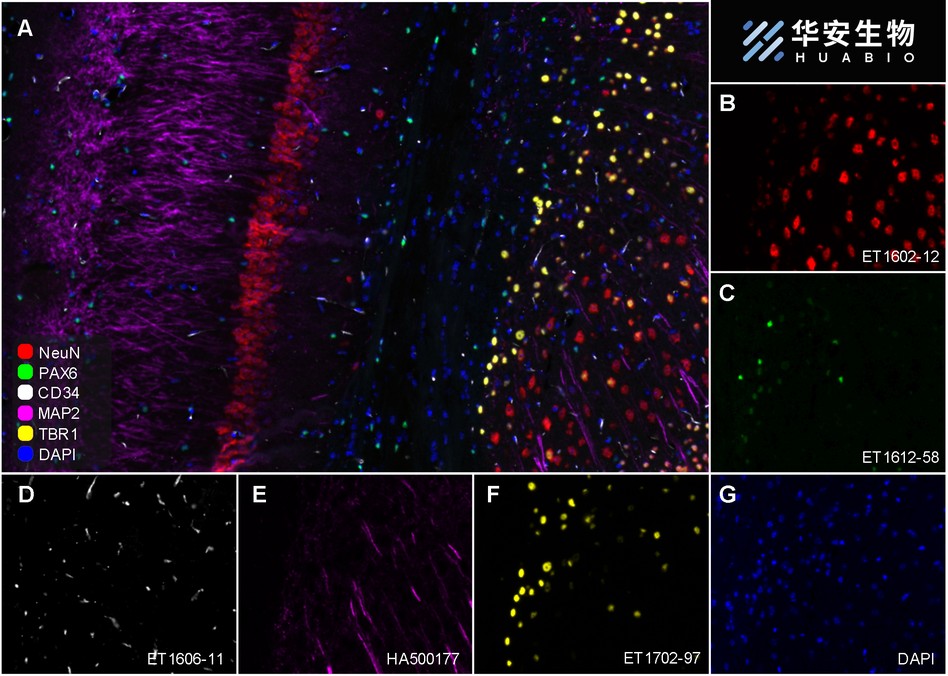 Immunohistochemical analysis of paraffin-embedded mouse cerebellum tissue with Rabbit anti-PAX6 antibody (ET1612-58) at 1/1,000 dilution.<br />
<br />
The section was pre-treated using heat mediated antigen retrieval with Tris-EDTA buffer (pH 9.0) for 20 minutes. The tissues were blocked in 1% BSA for 20 minutes at room temperature, washed with ddH2O and PBS, and then probed with the primary antibody (ET1612-58) at 1/1,000 dilution for 1 hour at room temperature. The detection was performed using an HRP conjugated compact polymer system. DAB was used as the chromogen. Tissues were counterstained with hematoxylin and mounted with DPX.