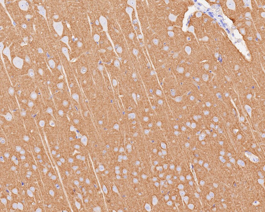Immunohistochemical analysis of paraffin-embedded rat brain tissue with Rabbit anti-mGluR2 antibody (ET1701-74) at 1/1,000 dilution.<br />
<br />
The section was pre-treated using heat mediated antigen retrieval with Tris-EDTA buffer (pH 9.0) for 20 minutes. The tissues were blocked in 1% BSA for 20 minutes at room temperature, washed with ddH2O and PBS, and then probed with the primary antibody (ET1701-74) at 1/1,000 dilution for 1 hour at room temperature. The detection was performed using an HRP conjugated compact polymer system. DAB was used as the chromogen. Tissues were counterstained with hematoxylin and mounted with DPX.