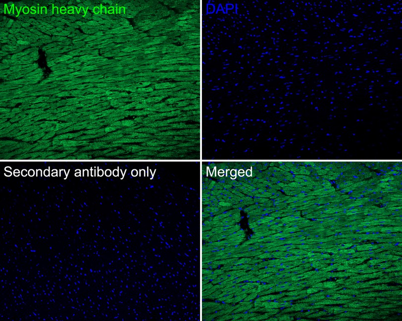 Immunofluorescence analysis of paraffin-embedded rat heart tissue labeling Myosin heavy chain with Rabbit anti-Myosin heavy chain antibody (ET1702-88) at 1/100 dilution.<br />
<br />
The section was pre-treated using heat mediated antigen retrieval with Tris-EDTA buffer (pH 9.0) for 20 minutes. The tissues were blocked in 10% negative goat serum for 1 hour at room temperature, washed with PBS, and then probed with the primary antibody (ET1702-88, green) at 1/100 dilution overnight at 4 ℃, washed with PBS.<br />
<br />
Goat Anti-Rabbit IgG H&L (iFluor™ 488, HA1121) was used as the secondary antibody at 1/1,000 dilution. Nuclei were counterstained with DAPI (blue).