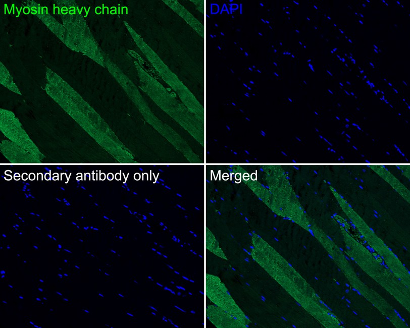 Immunofluorescence analysis of paraffin-embedded human striated muscle tissue labeling Myosin heavy chain with Rabbit anti-Myosin heavy chain antibody (ET1702-88) at 1/100 dilution.<br />
<br />
The section was pre-treated using heat mediated antigen retrieval with Tris-EDTA buffer (pH 9.0) for 20 minutes. The tissues were blocked in 10% negative goat serum for 1 hour at room temperature, washed with PBS, and then probed with the primary antibody (ET1702-88, green) at 1/100 dilution overnight at 4 ℃, washed with PBS.<br />
<br />
Goat Anti-Rabbit IgG H&L (iFluor™ 488, HA1121) was used as the secondary antibody at 1/1,000 dilution. Nuclei were counterstained with DAPI (blue).