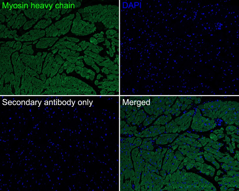 Immunofluorescence analysis of paraffin-embedded human heart tissue labeling Myosin heavy chain with Rabbit anti-Myosin heavy chain antibody (ET1702-88) at 1/100 dilution.<br />
<br />
The section was pre-treated using heat mediated antigen retrieval with Tris-EDTA buffer (pH 9.0) for 20 minutes. The tissues were blocked in 10% negative goat serum for 1 hour at room temperature, washed with PBS, and then probed with the primary antibody (ET1702-88, green) at 1/100 dilution overnight at 4 ℃, washed with PBS.<br />
<br />
Goat Anti-Rabbit IgG H&L (iFluor™ 488, HA1121) was used as the secondary antibody at 1/1,000 dilution. Nuclei were counterstained with DAPI (blue).