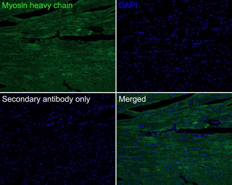 Immunofluorescence analysis of paraffin-embedded mouse heart tissue labeling Myosin heavy chain with Rabbit anti-Myosin heavy chain antibody (ET1702-88) at 1/100 dilution.<br />
<br />
The section was pre-treated using heat mediated antigen retrieval with Tris-EDTA buffer (pH 9.0) for 20 minutes. The tissues were blocked in 10% negative goat serum for 1 hour at room temperature, washed with PBS, and then probed with the primary antibody (ET1702-88, green) at 1/100 dilution overnight at 4 ℃, washed with PBS.<br />
<br />
Goat Anti-Rabbit IgG H&L (iFluor™ 488, HA1121) was used as the secondary antibody at 1/1,000 dilution. Nuclei were counterstained with DAPI (blue).