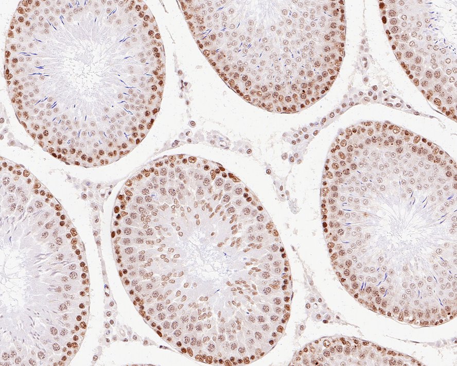 Immunohistochemical analysis of paraffin-embedded rat testis tissue with Rabbit anti-ASH2L antibody (ET1609-24) at 1/1,000 dilution.<br />
<br />
The section was pre-treated using heat mediated antigen retrieval with sodium citrate buffer (pH 6.0) for 2 minutes. The tissues were blocked in 1% BSA for 20 minutes at room temperature, washed with ddH2O and PBS, and then probed with the primary antibody (ET1609-24) at 1/1,000 dilution for 1 hour at room temperature. The detection was performed using an HRP conjugated compact polymer system. DAB was used as the chromogen. Tissues were counterstained with hematoxylin and mounted with DPX.