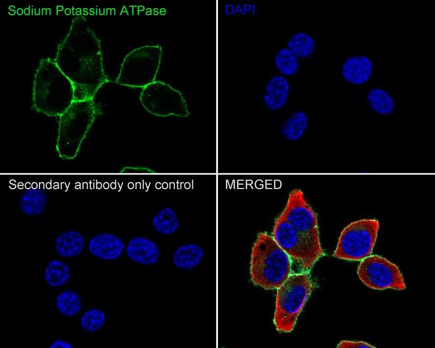 Immunofluorescence analysis of paraffin-embedded rat kidney tissue labeling Sodium Potassium ATPase with Rabbit anti-Sodium Potassium ATPase antibody (ET1609-76) at 1/200 dilution.<br />
<br />
The section was pre-treated using heat mediated antigen retrieval with Tris-EDTA buffer (pH 9.0) for 20 minutes. The tissues were blocked in 10% negative goat serum for 1 hour at room temperature, washed with PBS, and then probed with the primary antibody (ET1609-76, green) at 1/200 dilution overnight at 4 ℃, washed with PBS.<br />
<br />
Goat Anti-Rabbit IgG H&L (iFluor™ 488, HA1121) was used as the secondary antibody at 1/1,000 dilution. Nuclei were counterstained with DAPI (blue).