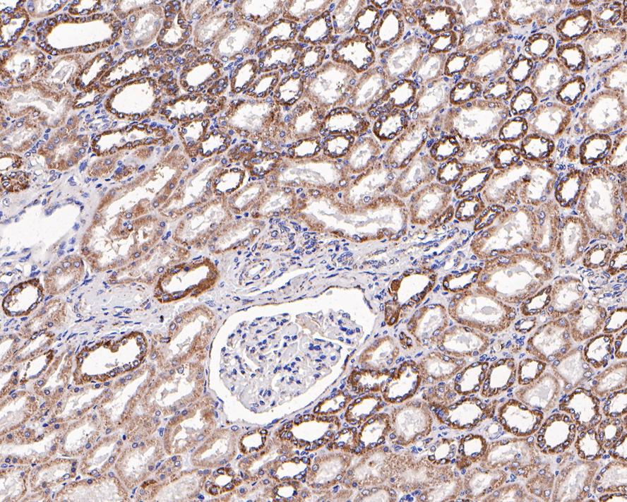 Immunohistochemical analysis of paraffin-embedded human kidney tissue with Rabbit anti-HSP60 antibody (1007-3) at 1/2,000 dilution.<br />
<br />
The section was pre-treated using heat mediated antigen retrieval with Tris-EDTA buffer (pH 9.0) for 20 minutes. The tissues were blocked in 1% BSA for 20 minutes at room temperature, washed with ddH2O and PBS, and then probed with the primary antibody (1007-3) at 1/2,000 dilution for 1 hour at room temperature. The detection was performed using an HRP conjugated compact polymer system. DAB was used as the chromogen. Tissues were counterstained with hematoxylin and mounted with DPX.