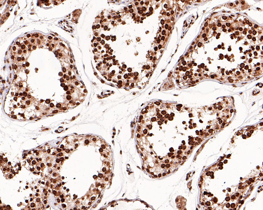 Immunohistochemical analysis of paraffin-embedded human testis tissue with Mouse anti-KLHDC3 antibody (M1310-1) at 1/200 dilution.<br />
<br />
The section was pre-treated using heat mediated antigen retrieval with Tris-EDTA buffer (pH 9.0) for 20 minutes. The tissues were blocked in 1% BSA for 20 minutes at room temperature, washed with ddH2O and PBS, and then probed with the primary antibody (M1310-1) at 1/200 dilution for 1 hour at room temperature. The detection was performed using an HRP conjugated compact polymer system. DAB was used as the chromogen. Tissues were counterstained with hematoxylin and mounted with DPX.