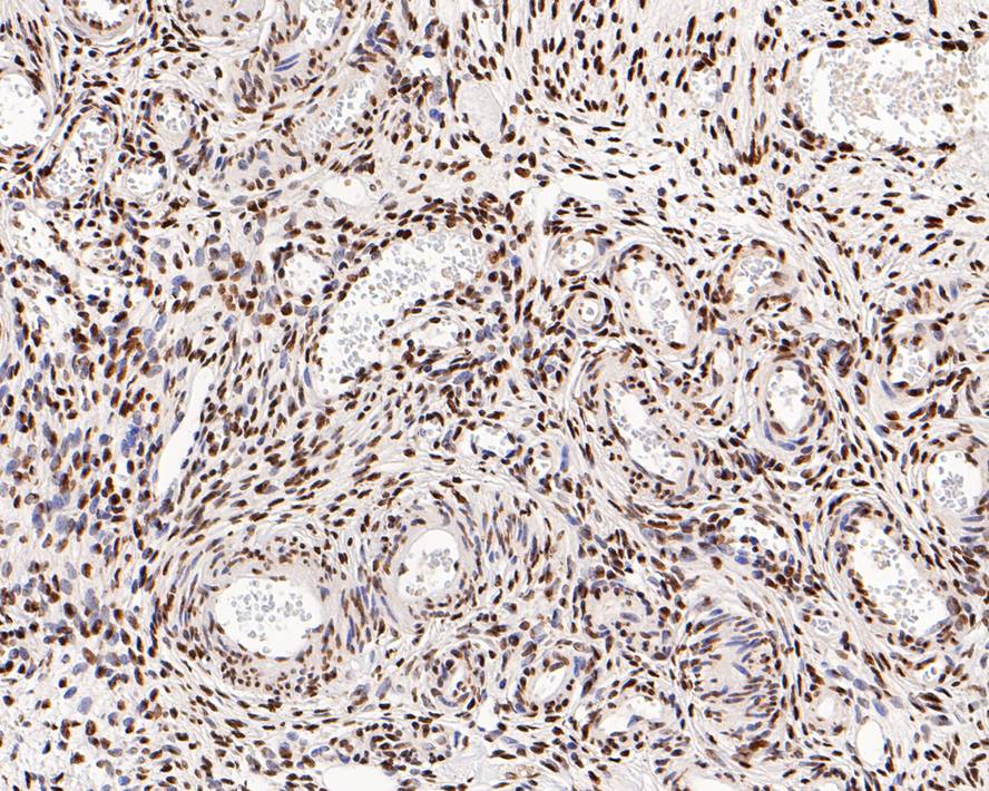 Immunohistochemical analysis of paraffin-embedded human ovary tissue with Mouse anti-KLHDC3 antibody (M1310-1) at 1/200 dilution.<br />
<br />
The section was pre-treated using heat mediated antigen retrieval with Tris-EDTA buffer (pH 9.0) for 20 minutes. The tissues were blocked in 1% BSA for 20 minutes at room temperature, washed with ddH2O and PBS, and then probed with the primary antibody (M1310-1) at 1/200 dilution for 1 hour at room temperature. The detection was performed using an HRP conjugated compact polymer system. DAB was used as the chromogen. Tissues were counterstained with hematoxylin and mounted with DPX.