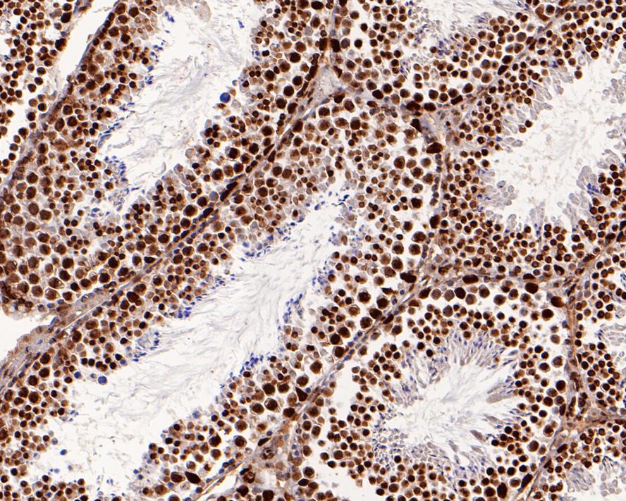 Immunohistochemical analysis of paraffin-embedded mouse testis tissue with Mouse anti-KLHDC3 antibody (M1310-1) at 1/200 dilution.<br />
<br />
The section was pre-treated using heat mediated antigen retrieval with Tris-EDTA buffer (pH 9.0) for 20 minutes. The tissues were blocked in 1% BSA for 20 minutes at room temperature, washed with ddH2O and PBS, and then probed with the primary antibody (M1310-1) at 1/200 dilution for 1 hour at room temperature. The detection was performed using an HRP conjugated compact polymer system. DAB was used as the chromogen. Tissues were counterstained with hematoxylin and mounted with DPX.