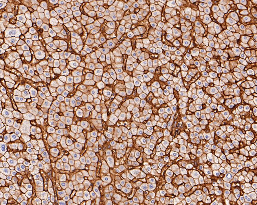 Immunohistochemical analysis of paraffin-embedded human liver tissue with Rabbit anti-Integrin beta 1 antibody (ET1601-17) at 1/200 dilution.<br />
<br />
The section was pre-treated using heat mediated antigen retrieval with Tris-EDTA buffer (pH 9.0) for 20 minutes. The tissues were blocked in 1% BSA for 20 minutes at room temperature, washed with ddH2O and PBS, and then probed with the primary antibody (ET1601-17) at 1/200 dilution for 1 hour at room temperature. The detection was performed using an HRP conjugated compact polymer system. DAB was used as the chromogen. Tissues were counterstained with hematoxylin and mounted with DPX.