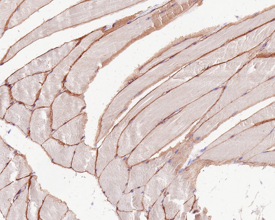 Immunohistochemical analysis of paraffin-embedded human striated muscle tissue with Rabbit anti-alpha sarcoglycan antibody (ET1704-25) at 1/1,000 dilution.<br />
<br />
The section was pre-treated using heat mediated antigen retrieval with Tris-EDTA buffer (pH 9.0) for 20 minutes. The tissues were blocked in 1% BSA for 20 minutes at room temperature, washed with ddH2O and PBS, and then probed with the primary antibody (ET1704-25) at 1/1,000 dilution for 1 hour at room temperature. The detection was performed using an HRP conjugated compact polymer system. DAB was used as the chromogen. Tissues were counterstained with hematoxylin and mounted with DPX.