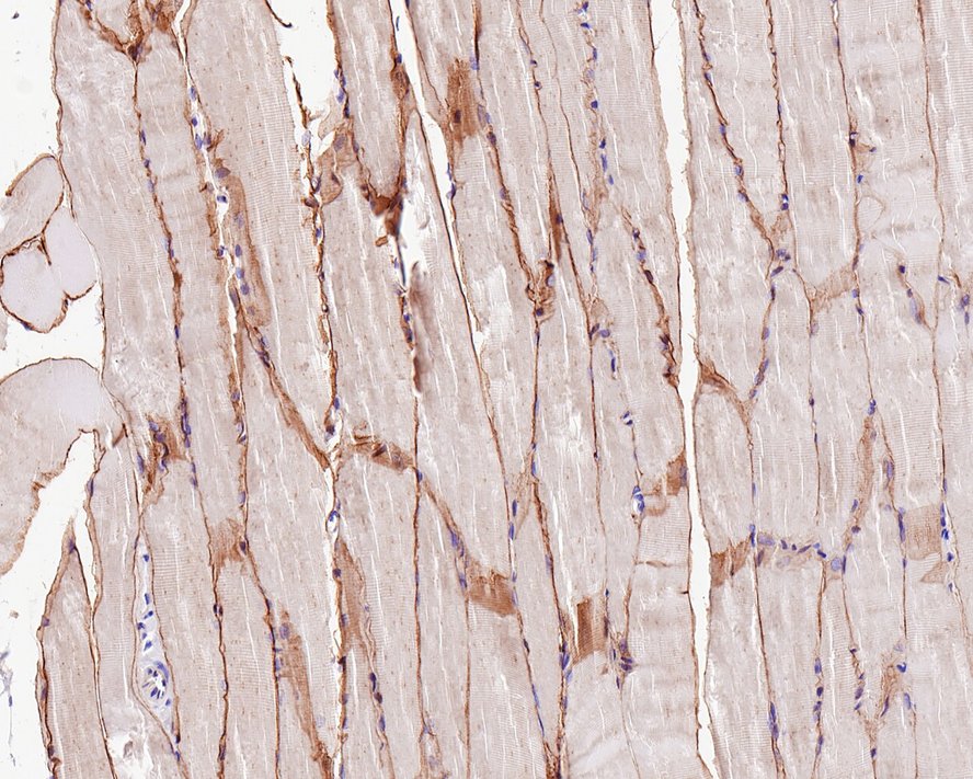 Immunohistochemical analysis of paraffin-embedded rat skeletal muscle tissue with Rabbit anti-alpha sarcoglycan antibody (ET1704-25) at 1/1,000 dilution.<br />
<br />
The section was pre-treated using heat mediated antigen retrieval with Tris-EDTA buffer (pH 9.0) for 20 minutes. The tissues were blocked in 1% BSA for 20 minutes at room temperature, washed with ddH2O and PBS, and then probed with the primary antibody (ET1704-25) at 1/1,000 dilution for 1 hour at room temperature. The detection was performed using an HRP conjugated compact polymer system. DAB was used as the chromogen. Tissues were counterstained with hematoxylin and mounted with DPX.